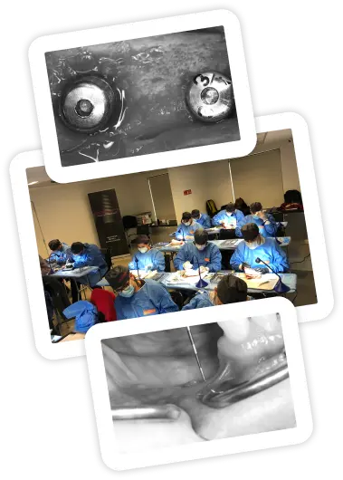 Surgical photographs of a bone reconstruction and a hands-on session